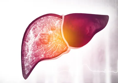 A liver with a diseased part is shown on the left and a healthy part is shown on the right.