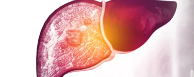A liver with a diseased part is shown on the left and a healthy part is shown on the right.
