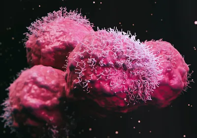 A 3D-rendered view of malignant cancer cells. 