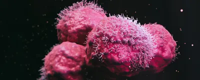 A 3D-rendered view of malignant cancer cells.