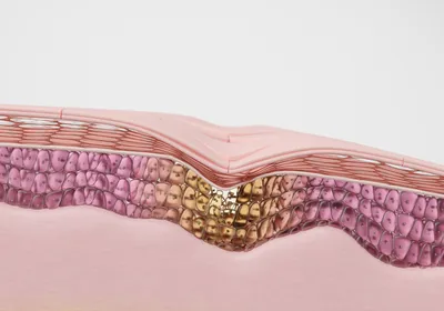 3D illustration of a skin cross section showing cells of the epidermis and dermis. A divot in the skin represents a healing injury, with the cells beneath it a light brown-yellow color compared to the surrounding pink cells. 