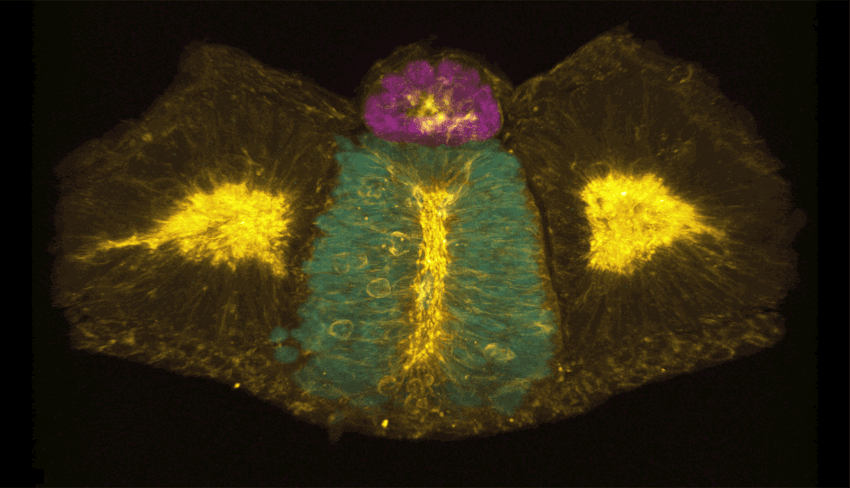 A microscopy image showing an angel-like figure with a cyan body, magenta head, and yellow wings.