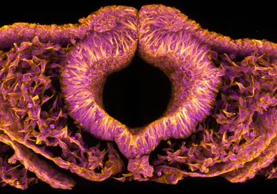 Embryo | The Scientist