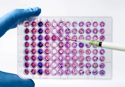 A photo of a scientist pipetting samples into a 96-well microplate.