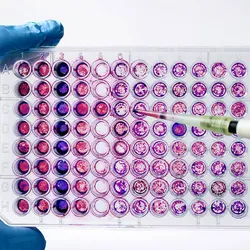 A photo of a scientist pipetting samples into a 96-well microplate.