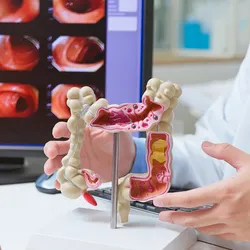 Image of the doctor explaining colonoscopy exam results with a patient.