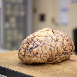 Photograph of a full human brain resting on a table in front of a blurred background. The tissue appears light in color with the crevices of the folds appearing a dark purple color. 
