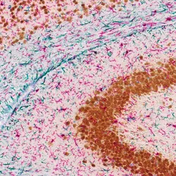A mouse brain section stained with NeuN (brown), Iba1 (red), GFAP (blue), and hematoxylin using the ChromoPlex III multiplex detection system on the BOND RX and scanned on the Aperio GT 450.