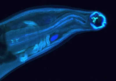 A hookworm glows blue against a black background.