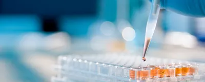 Gloved hand using a single-channel pipette on a clear 96-well plate in a lab.
