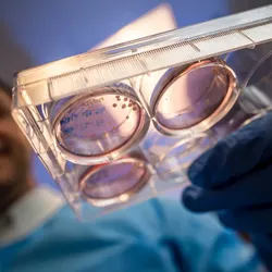 olorized brain organoid structure cultured in a lab, demonstrating organoid modeling for neuroscience and disease research.