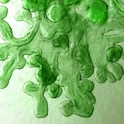 Green tissue, signifying intestinal organoids.