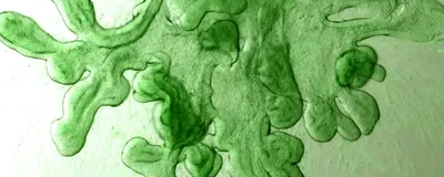 Green cells signifying intestinal organoids.