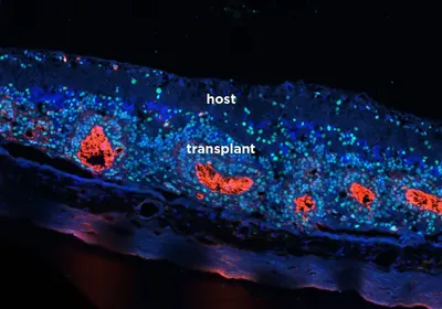 Retinal organoids showing blue and red cells.