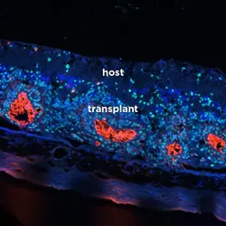 Retinal organoids showing blue and red cells.