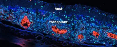 Retinal organoids showing blue and red cells.