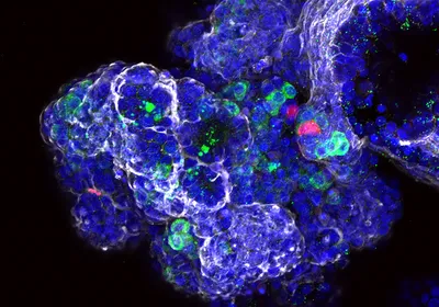 Image of human fetal pancreatic organoids stained in various colors. Nuclei are stained in blue, acinar cells in green, ductal cells in white, and endocrine cells in red.