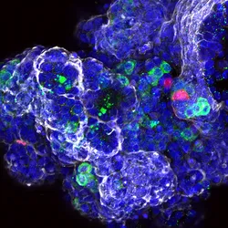 Image of human fetal pancreatic organoids stained in various colors. Nuclei are stained in blue, acinar cells in green, ductal cells in white, and endocrine cells in red.
