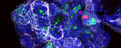 Image of human fetal pancreatic organoids stained in various colors. Nuclei are stained in blue, acinar cells in green, ductal cells in white, and endocrine cells in red.