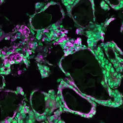 An image of cells with the center stained green and some cells stained magenta over a black background.