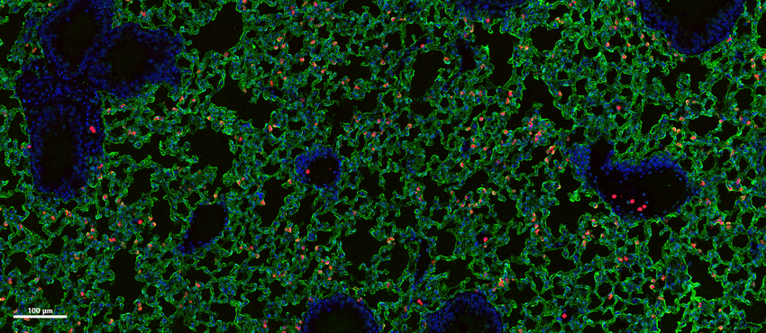 Cells appear green, red, and blue against a black background. Cells appear green, red, and blue against a black background.