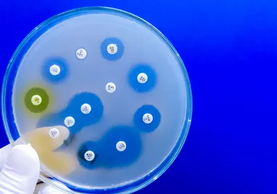 Antimicrobial susceptibility testing in petri dish, signifying AMR that SMART Toolkit aims to explain.