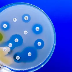Antimicrobial susceptibility testing in petri dish, signifying AMR that SMART Toolkit aims to explain.