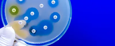 Antimicrobial susceptibility testing in petri dish, signifying AMR that SMART Toolkit aims to explain.