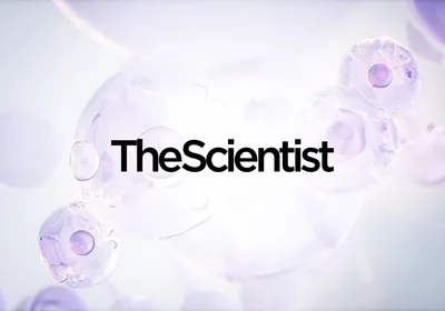 Scaling Human AT2 Cell Isolation for Translational Lung Research