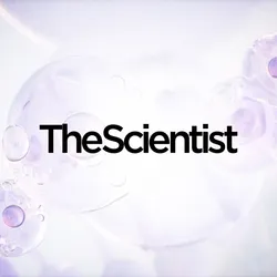 Scaling Human AT2 Cell Isolation for Translational Lung Research