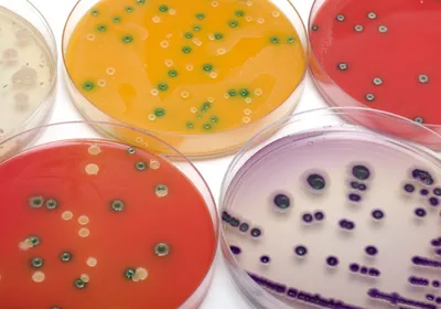 Image of multiple Petri dishes.