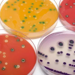 Image of multiple Petri dishes.