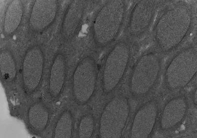 Electron micrograph of Wolbachia in the testes of N. vitripennis.