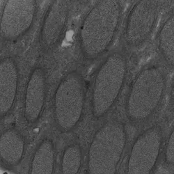 Electron micrograph of Wolbachia in the testes of N. vitripennis.