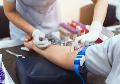 A nurse is taking a patient's blood test, signifying the NAD+ biomarkers in blood.