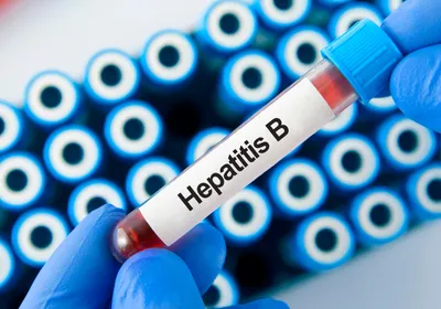 A blue-gloved hand holding a blood draw tube with a label ‘hepatitis B.’