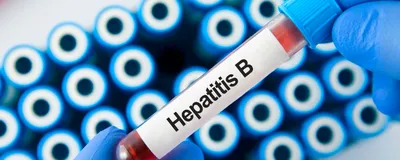 A blue-gloved hand holding a blood draw tube with a label ‘hepatitis B.’