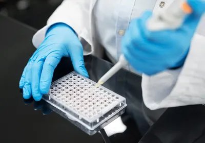 Scientist pipetting liquid into a multiwell plate for a laboratory assay.
