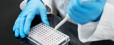 Scientist pipetting liquid into a multiwell plate for a laboratory assay.