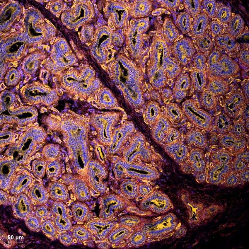Orange, yellow, and blue cells on a black background.