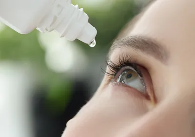 A woman puts an eye drop into her eye.