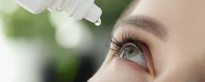 A woman puts an eye drop into her eye.