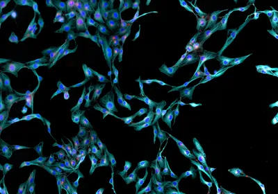Human skin fibroblast cells are shown via immunofluorescence, stained cyan, blue, and red.