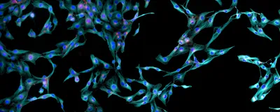 Human skin fibroblast cells are shown via immunofluorescence, stained cyan, blue, and red.