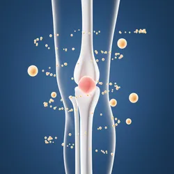 Yellow spheres and one red sphere encircle a knee bone joint, representing extracellular vesicles from menstrual blood stem cells as a treatment for cartilage breakdown in osteoarthritis.