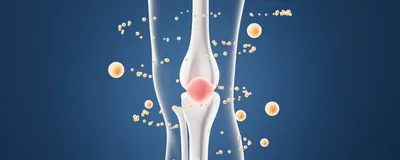 Yellow spheres and one red sphere encircle a knee bone joint, representing extracellular vesicles from menstrual blood stem cells as a treatment for cartilage breakdown in osteoarthritis.