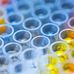 Close-up of multiwell plate wells holding clear and yellow biologic samples for endotoxin testing 