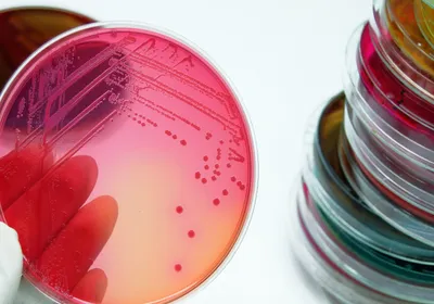 An agar plate with E. coli.