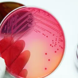 An agar plate with E. coli.