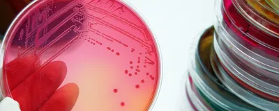 An agar plate with E. coli.